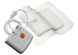 Smith & Nephew 66800956 Pico Negative Pressure Wound Therapy Kit, Single Use, Includes: Sterile Pump, (2) Ns Lithium Batteries, (2) Sterile Dressings 6" x 12", (10) Sterile Fixation Strips